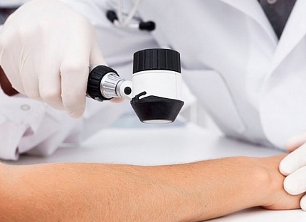 Диагностика нейродермита