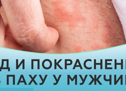 Кожный зуд в паху