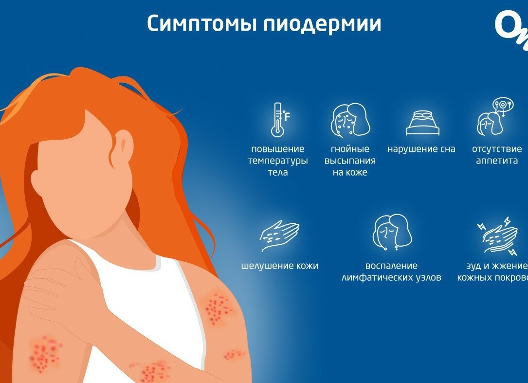 Профилактика пиодермии