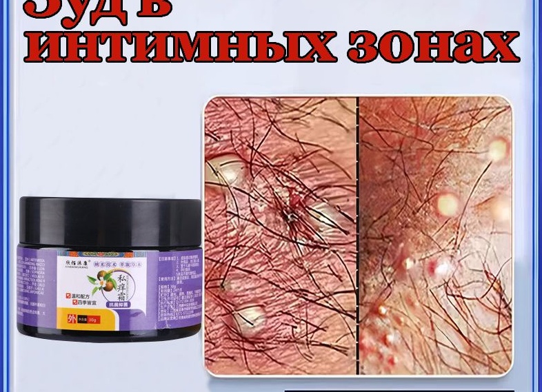 Кожный зуд в области половых органов