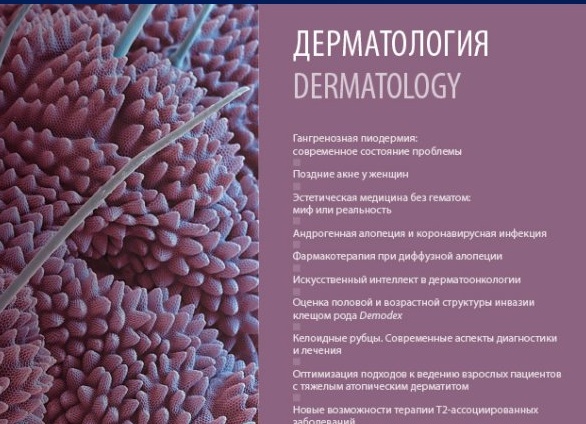 Дерматолог поставил диагноз пиодермия