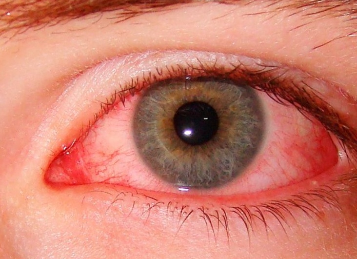 Можно ли спать в линзах