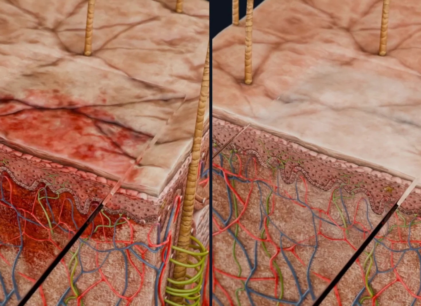 Диагностика кожной сыпи