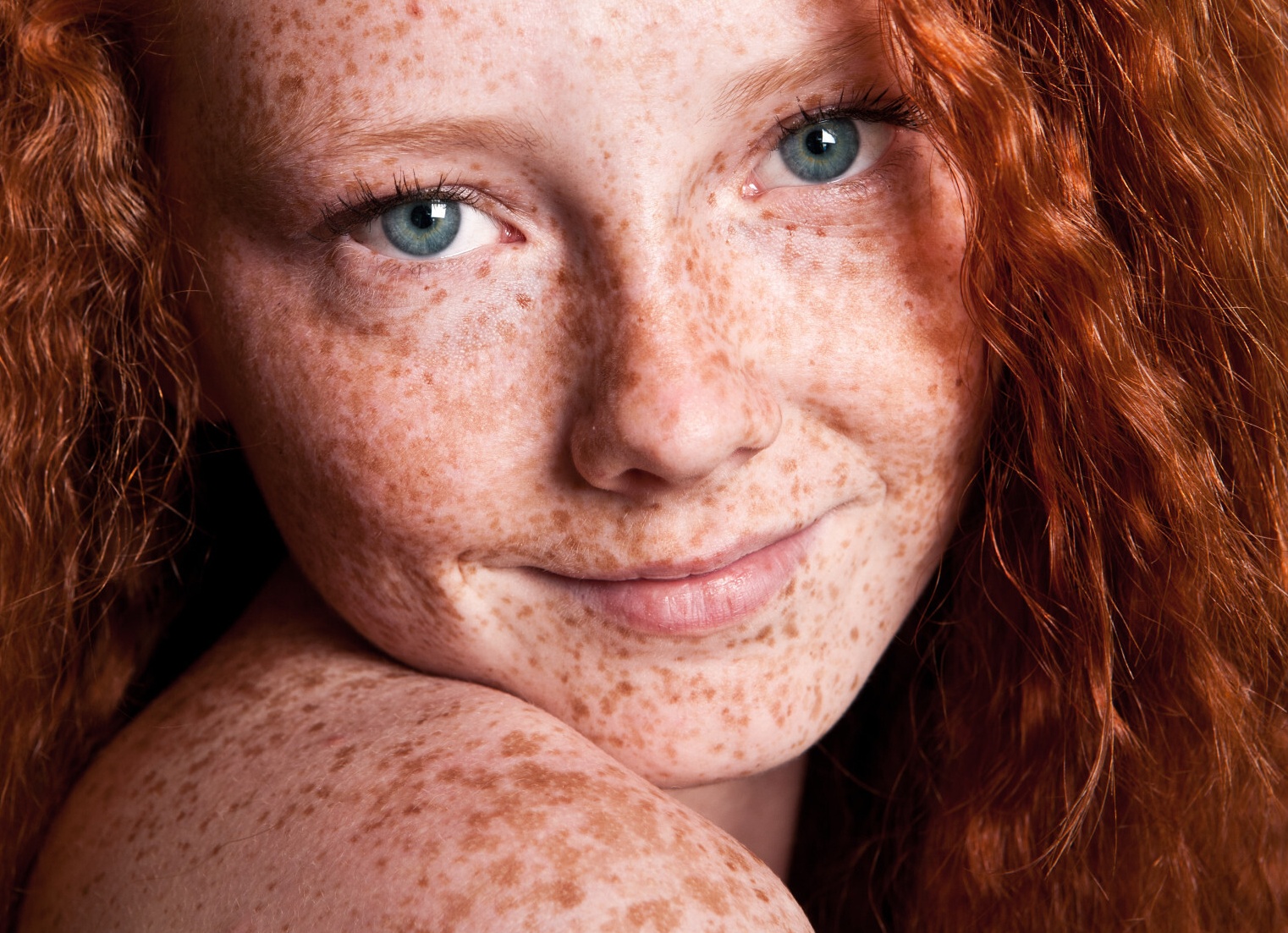 Как избавиться от веснушек