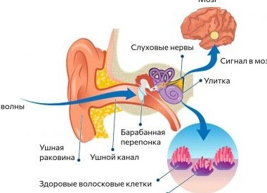 Звон в ушах: каковы причины и как избавиться