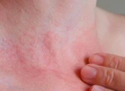 Причины появления пятен на коже у ребенка