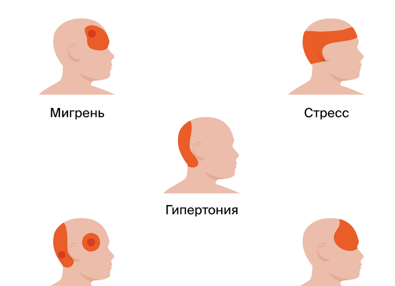 Почему болит голова и что с ней делать
