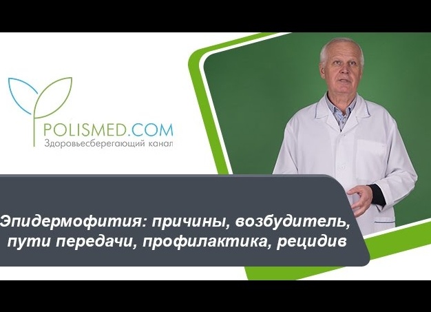 Профилактика эпидермофитии