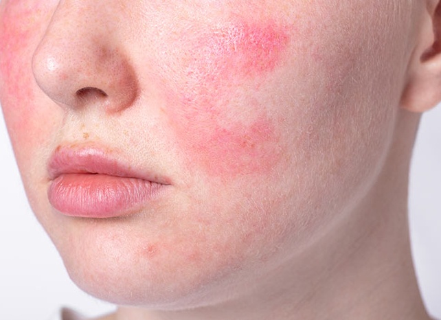 Диагностика пятен на коже