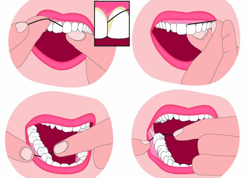 Нужно ли пользоваться зубной нитью и как это делать правильно
