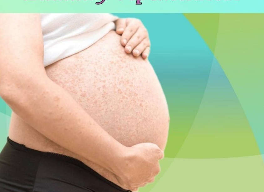 Отрубевидный лишай у беременных