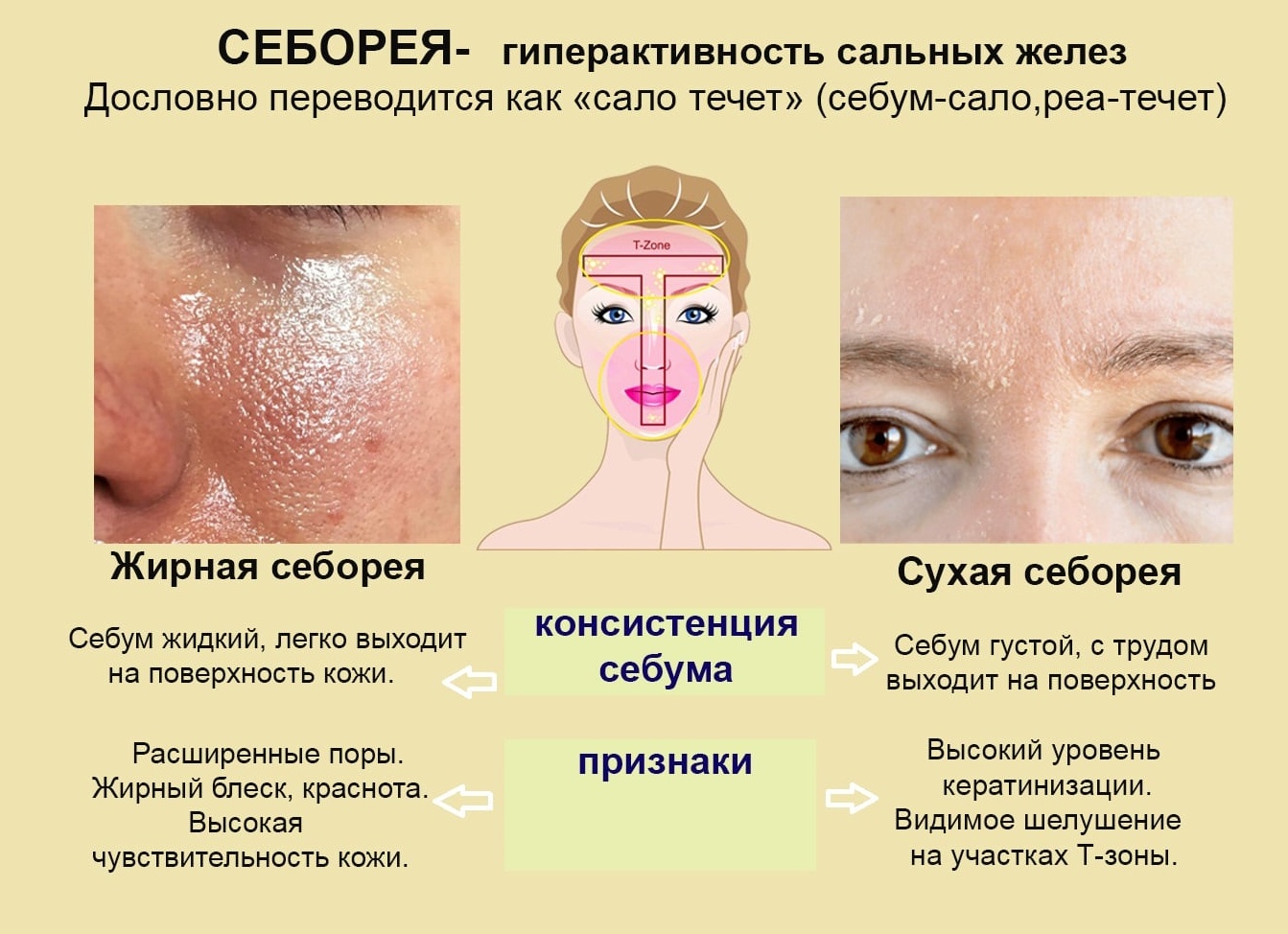 Диагностика себореи