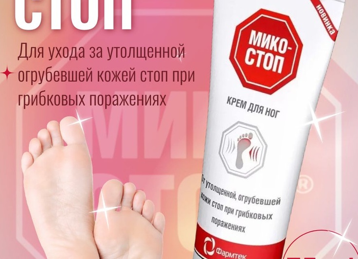 Характерные особенности микоза ног