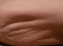 Откуда берутся судороги и что с ними делать