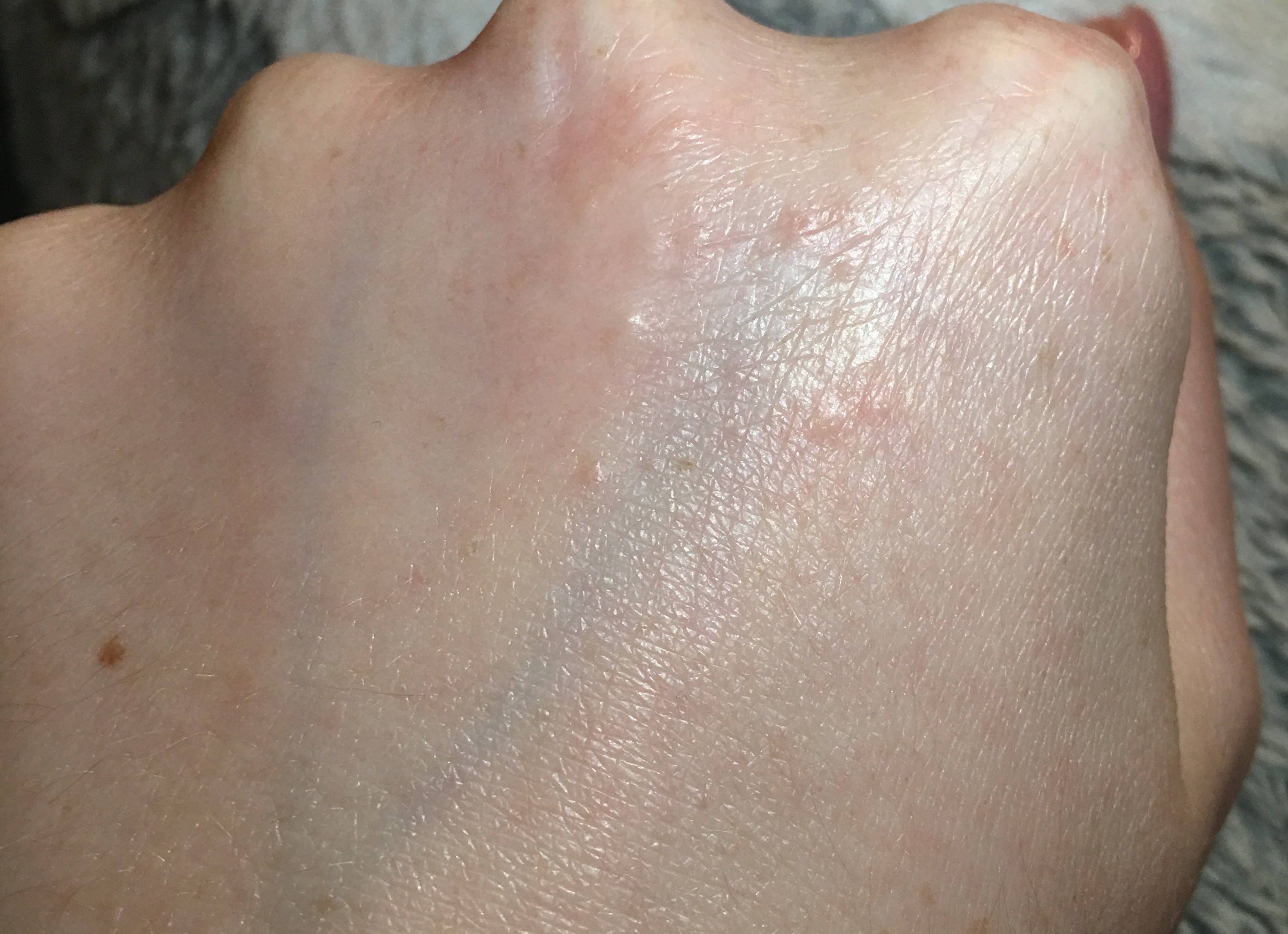 На руках появилась кожная сыпь